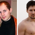 Хирург Давыдов предположил, что Павел Дуров изменил форму ушей